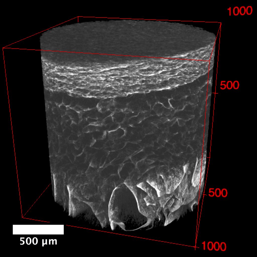 Microcomputed tomographical rendering of multizonal scaffold, containing distinct regions that mimic the orientations of the superficial, transition, calcified cartilage, and osseous zones of osteochondral tissue.