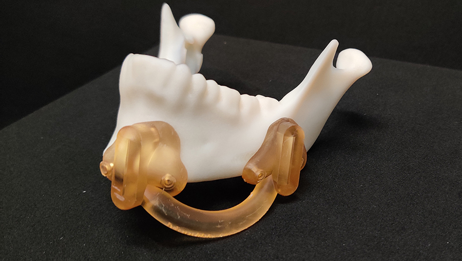 photo of An example of a 3D-printed anatomical model/guide that might be used to tackle a patient-specific health issue. 